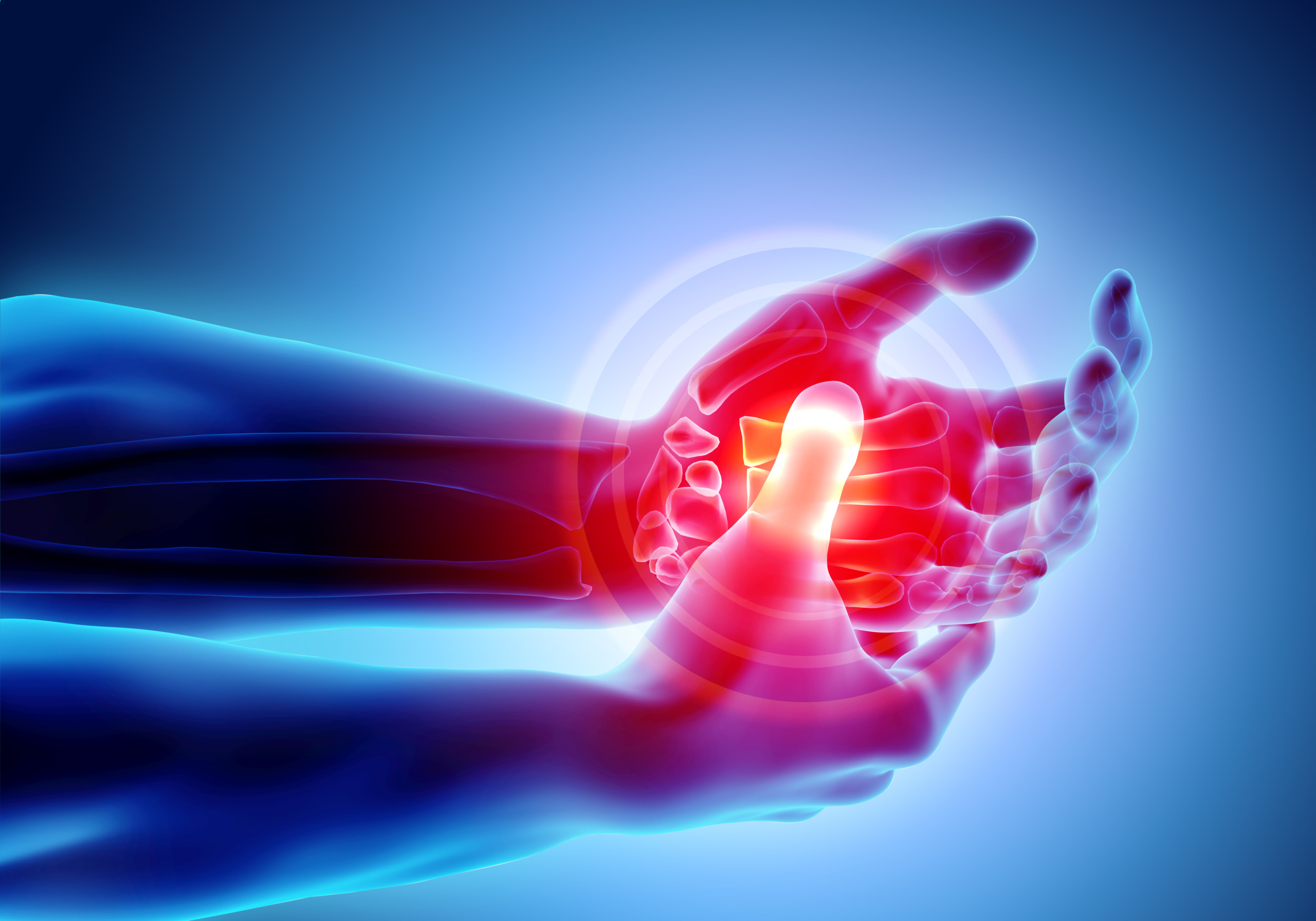 Rheuma: Schmerzen in der Hand